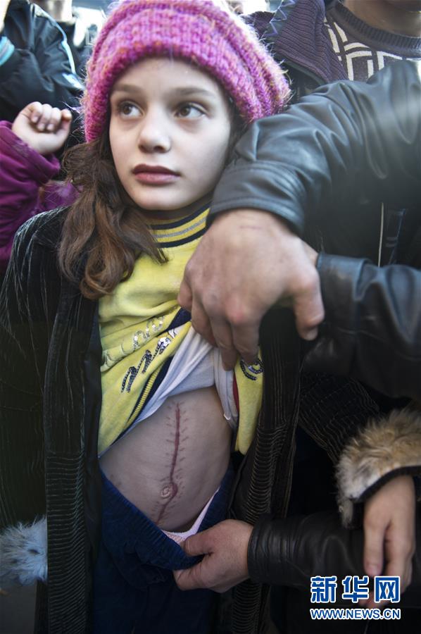 When will peace embrace Syria?